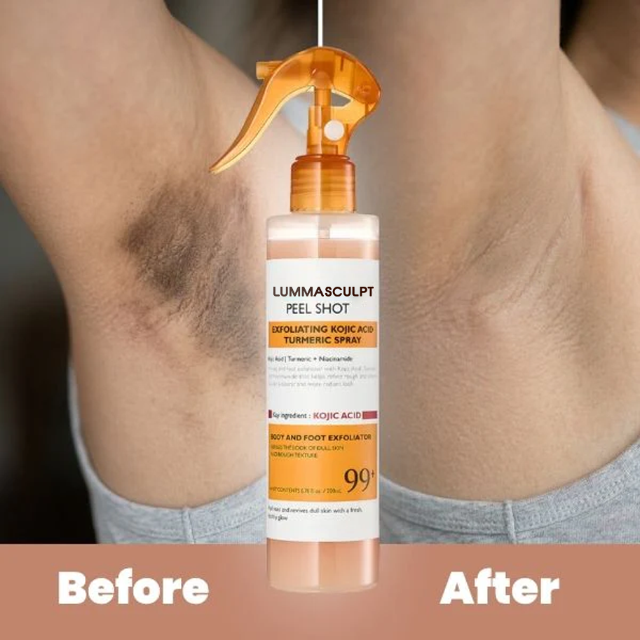 Body Peel Spray - Kojic + Turmeric