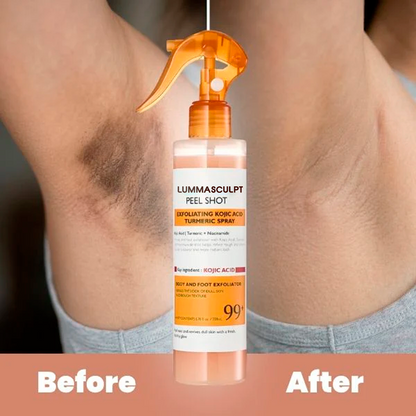 Body Peel Spray - Kojic + Turmeric