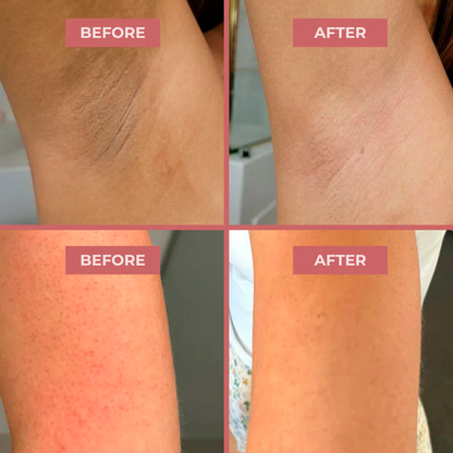 Body Peel Spray - Kojic + Turmeric