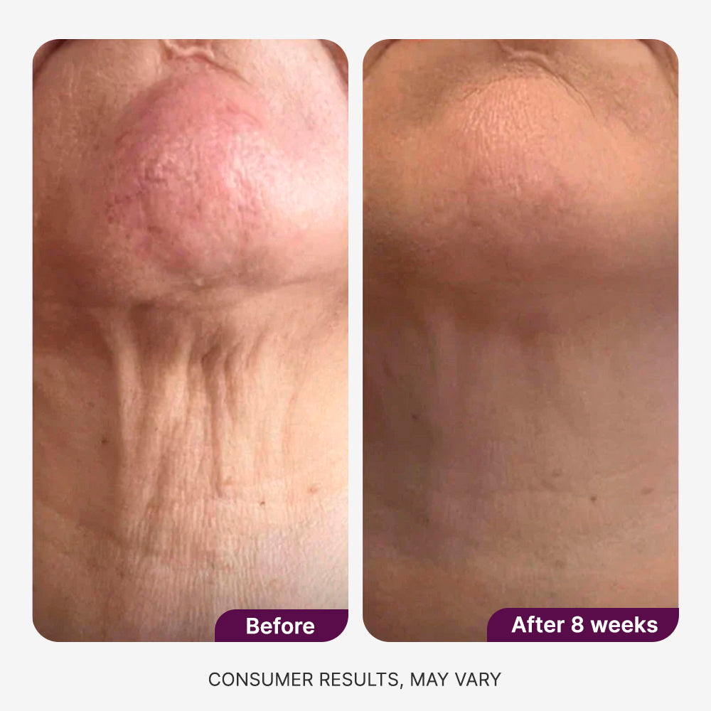 Neck Revival Cream