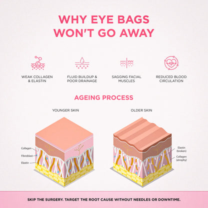 RevitalEyes® 2-in-1 Red Light Therapy + EMS To Erase Eye Bags