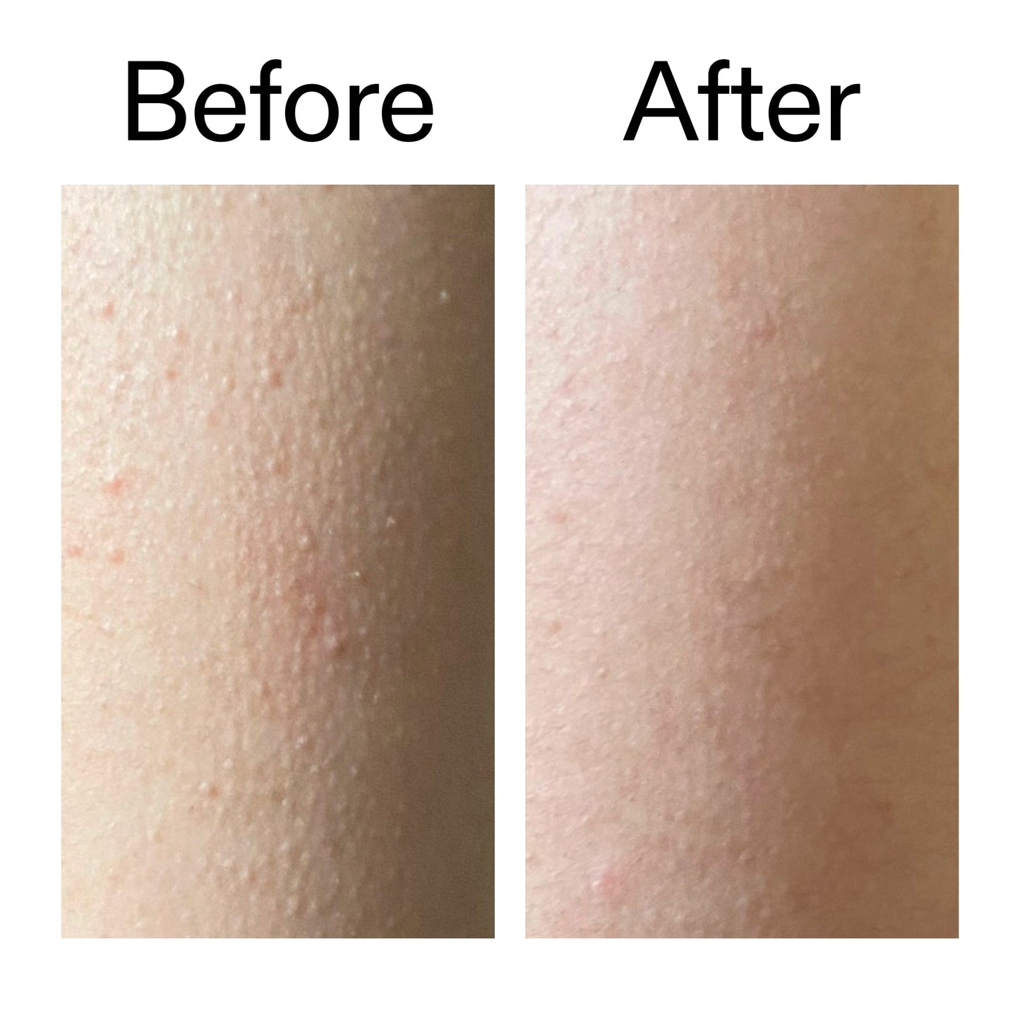 Glycolic Acid Exfoliating Body Stick applied on shoulder