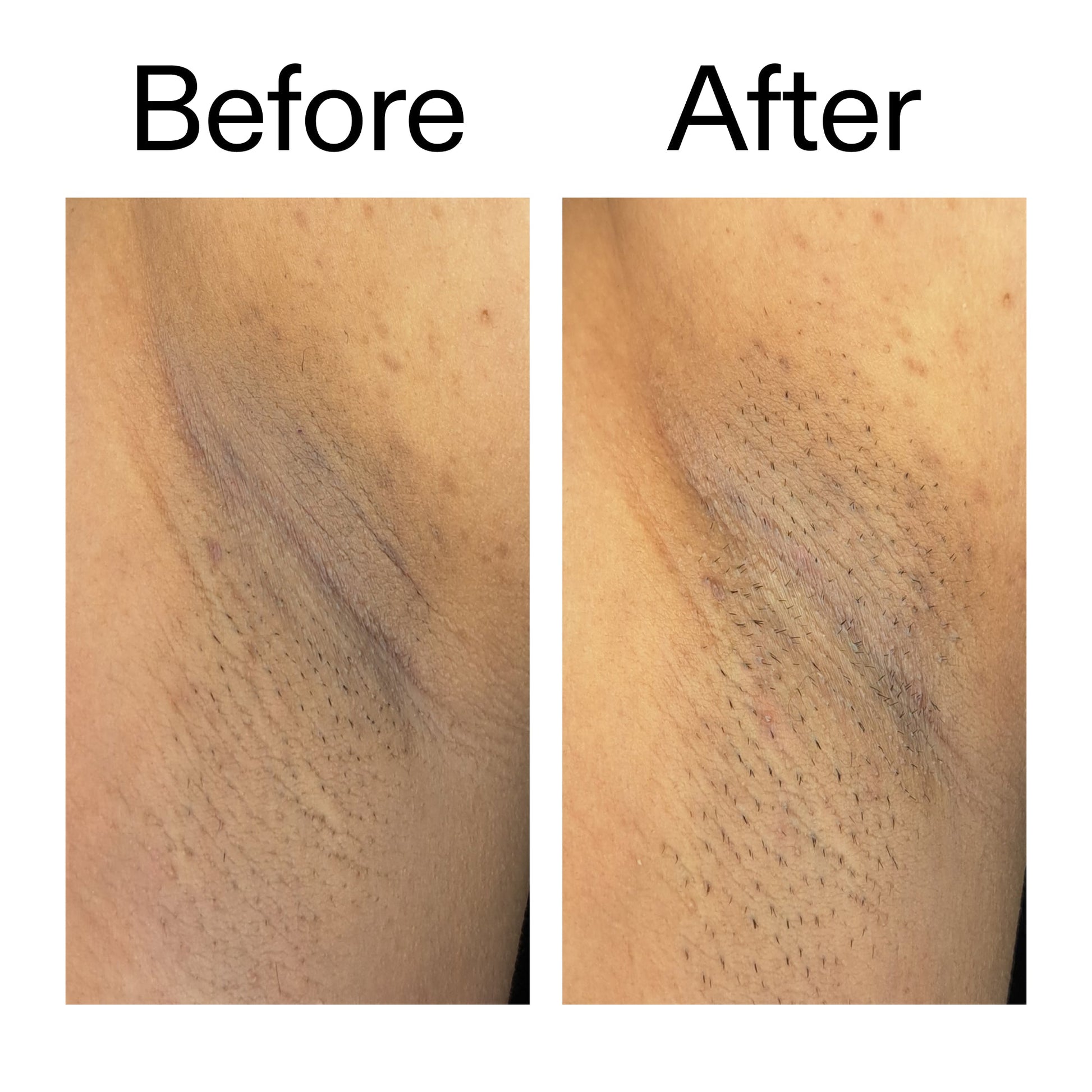 Before and after — rough texture visibly smoother