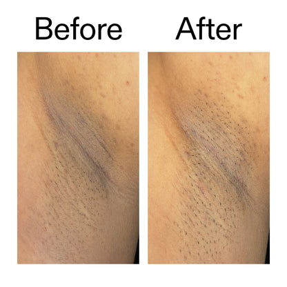 Before and after — rough texture visibly smoother
