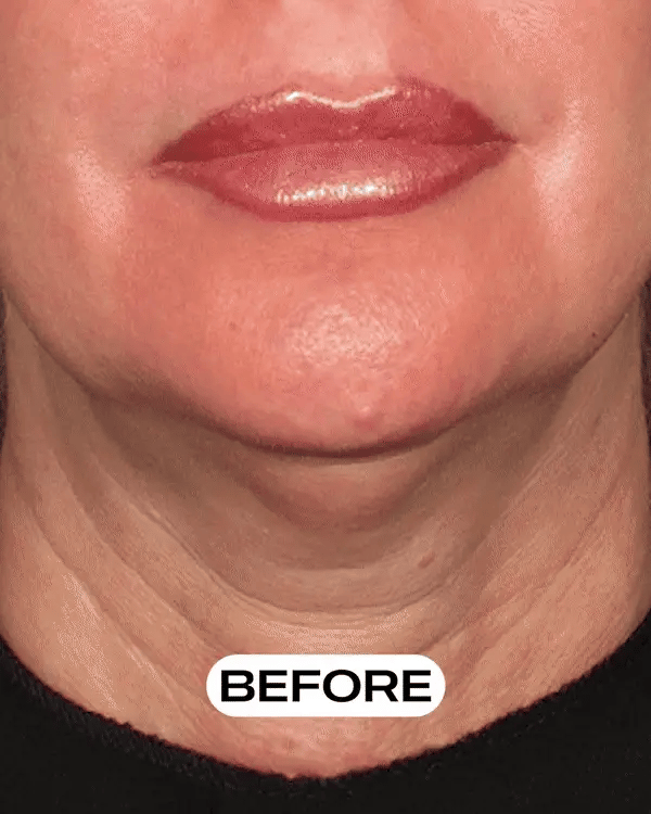 Youthful Glow Neck Cream