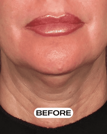 Youthful Glow Neck Cream
