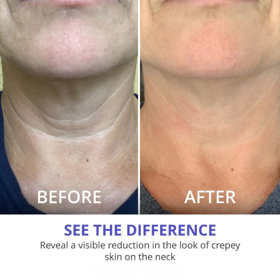 Youthful Glow Neck Cream